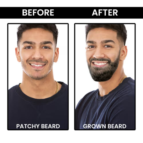 Love jojo-Beard Growth Oil